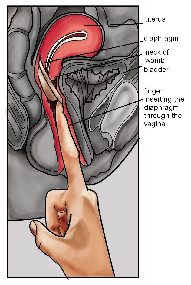 diaphragm
