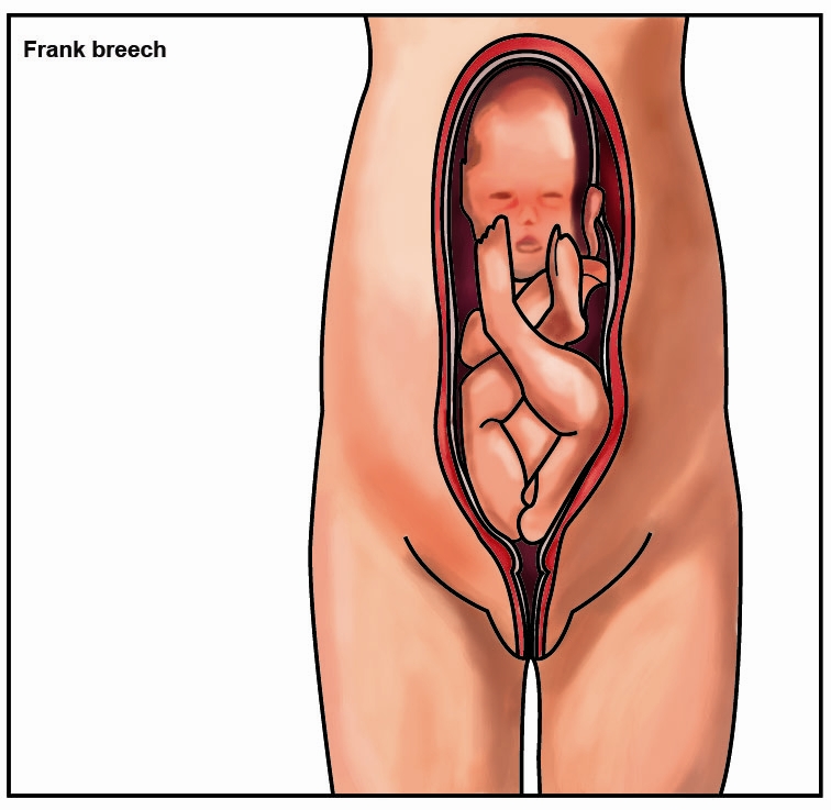 PREGNANCY37